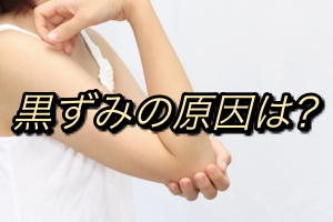 肘や膝の黒ずみの原因について